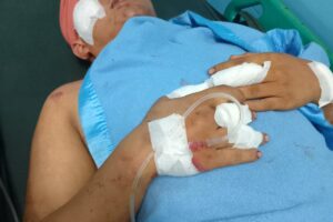 Orang Tua dan Keluarga Besar Menuntut Keadilan , Agar Kepolisian Polres Cilegon Segera Menangkap Pelaku Pengeroyokan