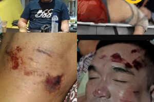 Komnas HAM – RI Mengeluarkan Rekomendasi Kepada Kepolisian Republik Indonesia, Atas Perkara Dugaan Penyiksaan Yang Berujung Kematian Salah Seorang Warga Di Makassar